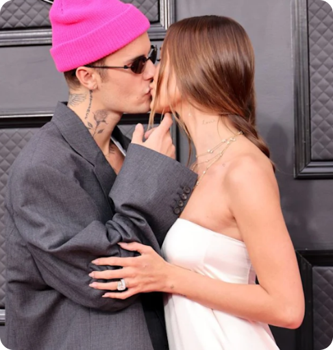 Baci AI con le celebrità